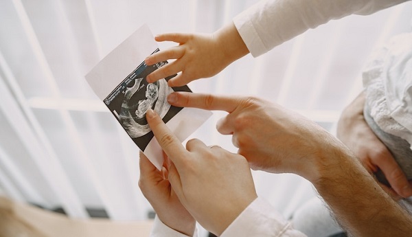 La position fœtale de votre bébé et ce qu'elle peut signifier pour son accouchement: photo de plusieurs mains tenant une image échographique